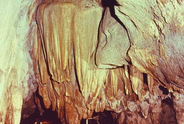 Giant Molar (Lake Room)